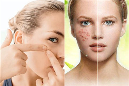 想要做個完美的新娘?請在婚前三個月把這些安排上! 第3張